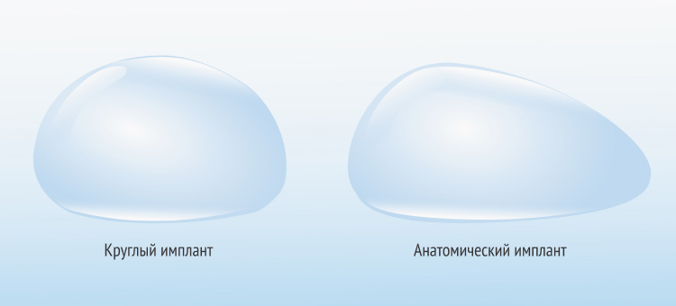 Круглый имплант (слева) и анатомический имплант (справа)